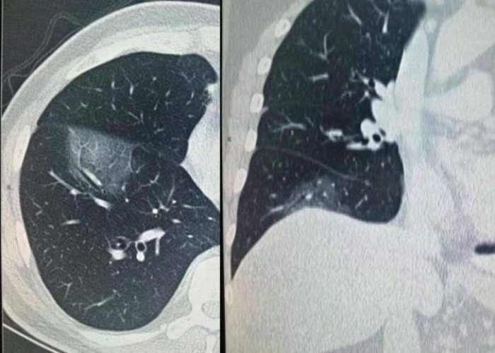 广东疫情最新人数:广东疫情最新人数统计