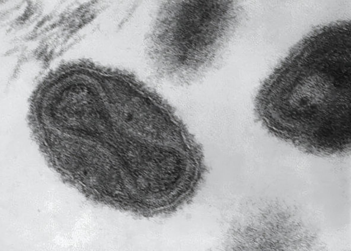 中国疫情啥时候结束的:中国疫情啥时候结束的啊