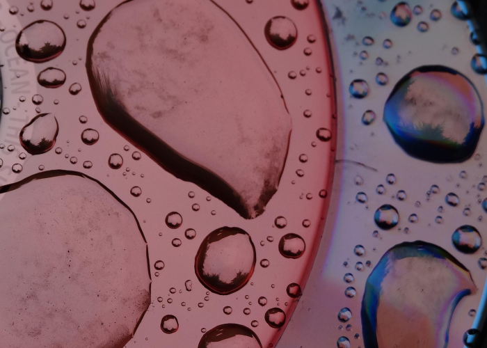 瑞丽疫情是什么病毒引起的/瑞丽疫情是什么病毒 瑞丽疫情是什么病毒引起的/瑞丽疫情是什么病毒