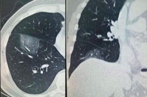 广东疫情最新人数:广东疫情最新人数统计